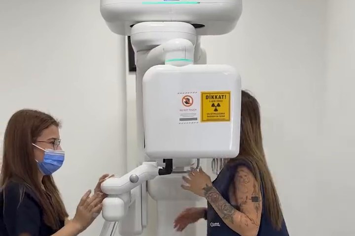 Panoramic X-ray at the clinic — the scan behind your written plan